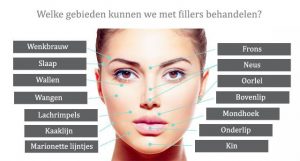 Botox behandelingen in Eelde-Paterswolde, Groningen en Haren